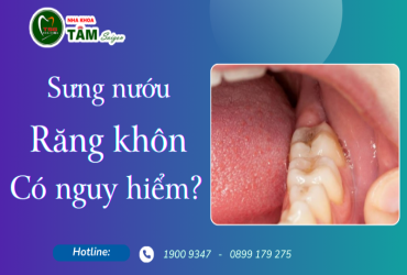 SƯNG NƯỚU RĂNG KHÔN CÓ NGUY HIỂM KHÔNG?