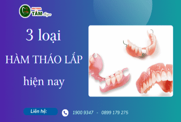 3 LOẠI HÀM THÁO LẮP PHỔ BIẾN HIỆN NAY 