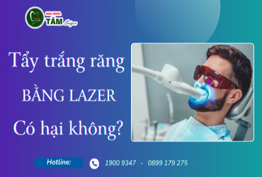 TẨY TRẮNG RĂNG BẰNG LAZER CÓ HẠI KHÔNG?