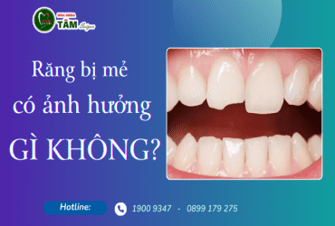 RĂNG BỊ MẺ CÓ ẢNH HƯỞNG GÌ KHÔNG?