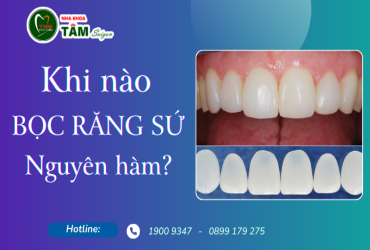 KHI NÀO NÊN BỌC RĂNG SỨ NGUYÊN HÀM?