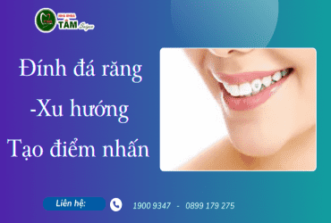 ĐÍNH ĐÁ LÊN RĂNG - XU HƯỚNG TẠO ĐIỂM NHẤN NỤ CƯỜI 