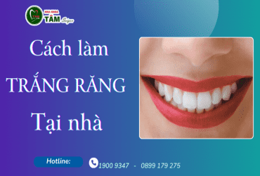 CÁCH LÀM TRẮNG RĂNG NGAY TẠI NHÀ 