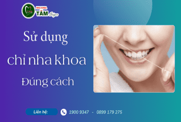 NHỮNG LƯU Ý SỬ DỤNG CHỈ NHA KHOA ĐÚNG CÁCH 