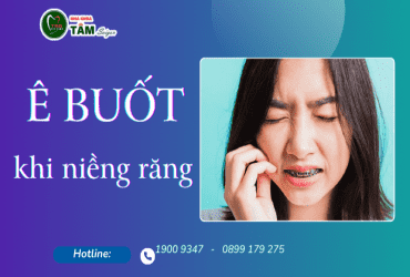 Ê BUỐT KHI NIỀNG RĂNG 