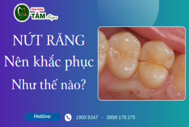 NỨT RĂNG NÊN KHẮC PHỤC NHƯ THẾ NÀO?