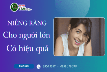 NIỀNG RĂNG CHO NGƯỜI LỚN CÓ HIỆU QUẢ 