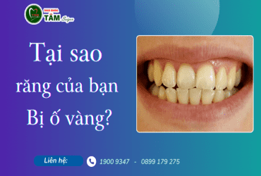 TẠI SAO RĂNG BỊ Ố VÀNG VÀ NHỮNG ĐIỀU CẦN BIẾT 