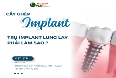 TRỤ IMPLANT BỊ LUNG LAY PHẢI LÀM SAO? 