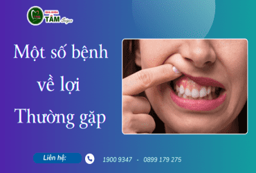 MỘT SỐ BỆNH VỀ LỢI THƯỜNG GẶP 