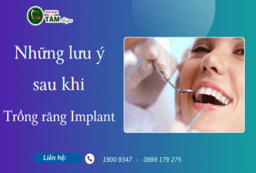 NHỮNG LƯU Ý SAU KHI TRỒNG RĂNG IMPLANT 