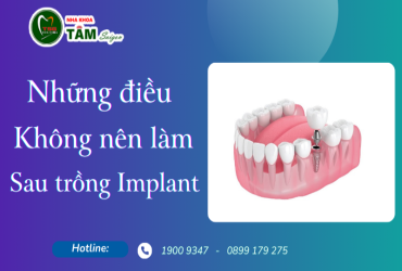 KHÔNG NÊN LÀM GÌ SAU KHI CẤY GHÉP RĂNG IMPLANT 