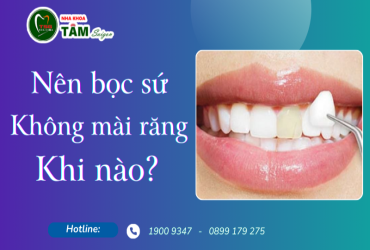 NÊN BỌC RĂNG SỨ KHÔNG MÀI RĂNG KHI NÀO?