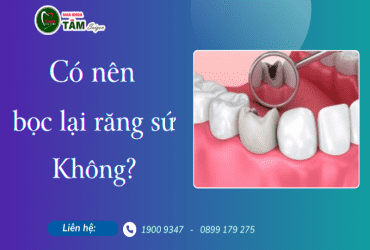 CÓ NÊN BỌC LẠI RĂNG SỨ KHÔNG?