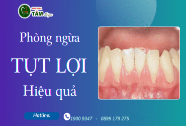 PHÒNG NGỪA TỤT LỢI HIỆU QUẢ 