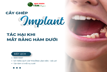 TÁC HẠI CỦA VIỆC MẤT RĂNG HÀM DƯỚI 