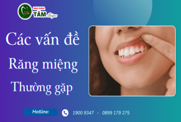 CÁC VẤN ĐỀ RĂNG MIỆNG THƯỜNG GẶP 