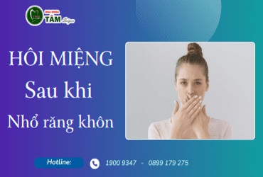 HÔI MIỆNG SAU KHI NHỔ RĂNG KHÔN 