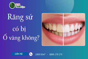 RĂNG SỨ CÓ BỊ Ố VÀNG KHÔNG?