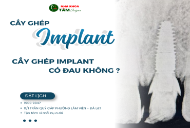 CẤY GHÉP RĂNG IMPLANT CÓ ĐAU KHÔNG? 