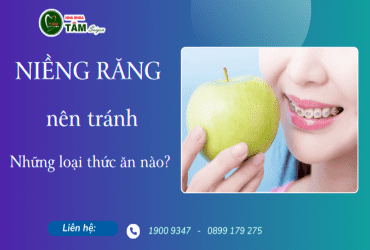 NHỮNG LOẠI THỨC ĂN NÊN TRÁNH KHI ĐANG NIỀNG RĂNG