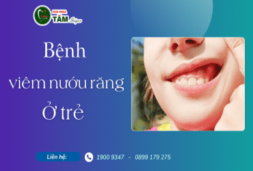 BỆNH VIÊM NƯỚU RĂNG Ở TRẺ 