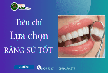 TIÊU CHÍ LỰA CHỌN RĂNG SỨ TỐT 