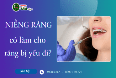 NIỀNG RĂNG CÓ LÀM CHO RĂNG YẾU ĐI? 