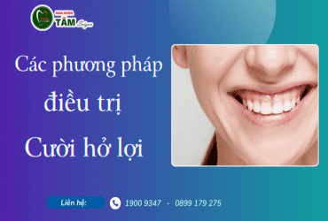 CÁC PHƯƠNG PHÁP ĐIỀU TRỊ CƯỜI HỞ LỢI 