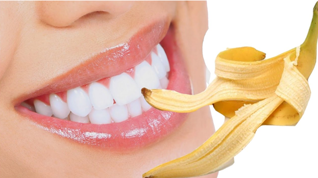 Cách nhanh nhất để tẩy ố vàng răng