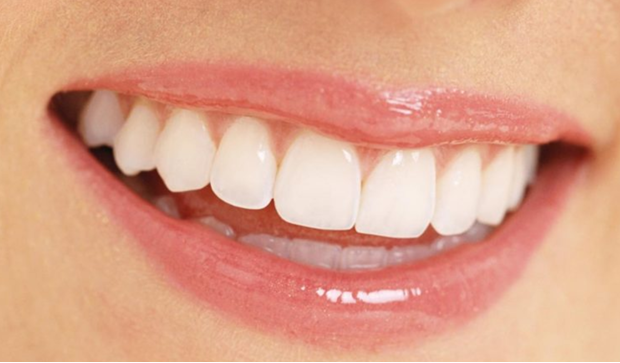 Cạo vôi răng có ảnh hưởng sức khỏe không
