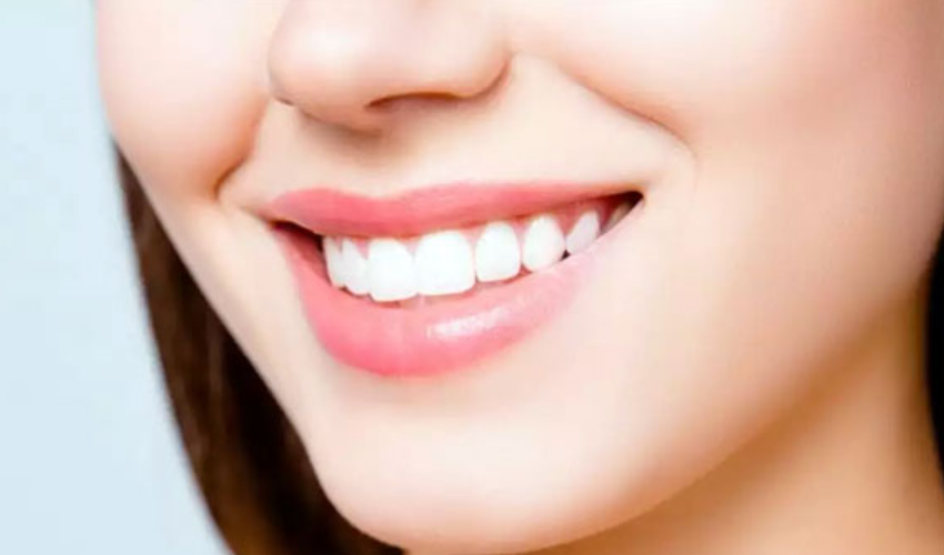 Tiêu chuẩn của một hàm răng đẹp - Nha Khoa Tâm Sài Gòn